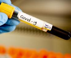 Стали известны новые признаки заболевания коронавирусом. 